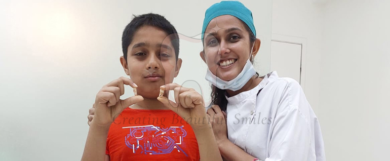 tooth aligner treatment in bandra west